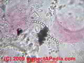Aspergillus niger spore chain (C) Daniel Friedman