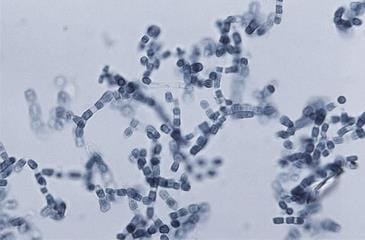 Coccioides soil fungus, U.S. CDC - see Valley Fever  @ Inspectapedia.com