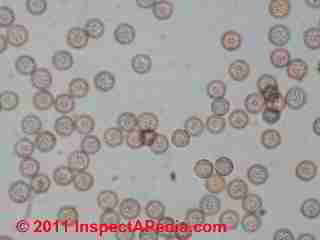 Stemonitis mold spores (C) Daniel Friedman
