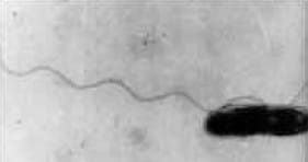 Photograph of Legionella bacterium, provided by the U.S. Department of Labor, OSHA