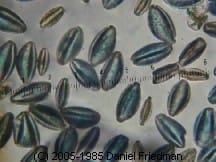 Photograph of poppy pollen grains