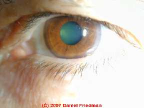 Photograph closeup of a home inspector's eye