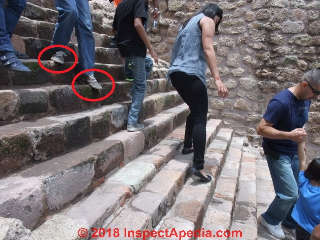 Dangerous foot placement descending a stone stairway (C) Daniel Friedman