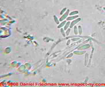 Acremonium mold photograph (C) Daniel Friedman