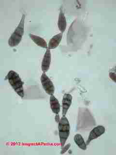 Alternaria mold spores in chain (C) Daniel Friedman