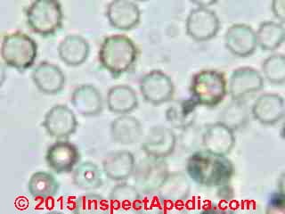 Aspergillus fumigatus under the microscope (C) Daniel Friedman