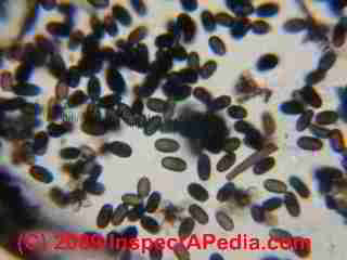 Black mold under the microscope Stachybotrys chartarum (C) Daniel Friedman
