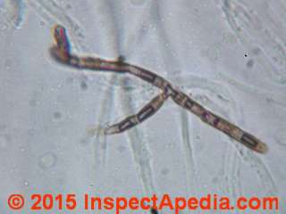 Hyphal fragment isolated from fiberglass building insulation (C) Daniel Friedman