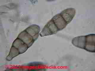 Ulocladium chartarum mold spores © D Friedman at InspectApedia.com 