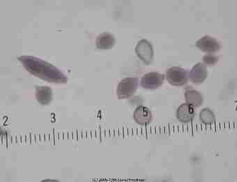 Cladosporium mold spores  © Daniel Friedman 2001