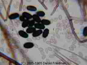 Photograph of Stachybotrys chartarum mold spores