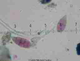 Alternaria mold spores - © 2017  - 2001  Daniel Friedman