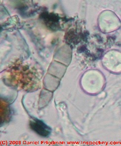 Photograph of Fusariella bizzozeriana mold spore