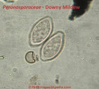 Peronospora or Downy Mildew under the microscope - at InspectApedia.com