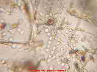 Photograph of mold spores of Aspergillus sp. found in crawl space fiberglass insulation.