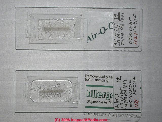 Air sampling cassette slide preparation (C) Daniel Friedman