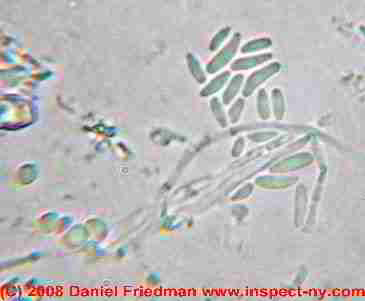 Photograph of Acremonium mold spores - &copy; Daniel Friedman.