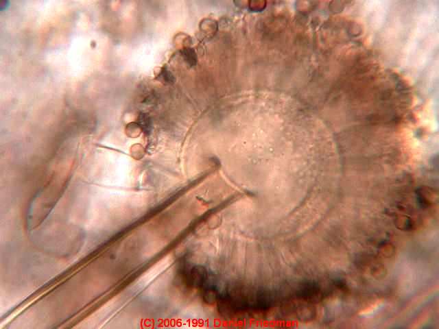Photograph of an Aspergillus niger conidiophore - &copy; Daniel Friedman.