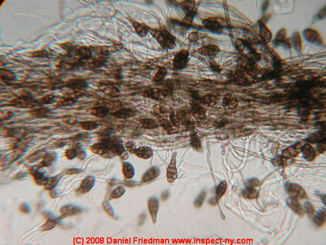 Photograph of Alternaria mold spores - &copy; Daniel Friedman.