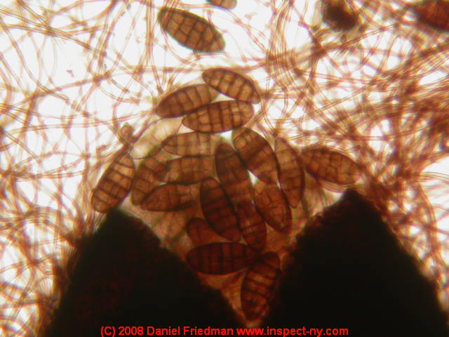 Photograph of an ascomycete mold Pleospora - &copy; Daniel Friedman.