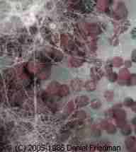 Aspergillis Structure - Daniel Friedman 05-02-00