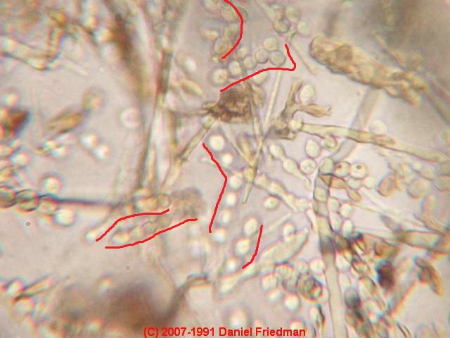 Indoor air particles of fiberglass and Pen Asp spore chains © D Friedman at InspectApedia.com 