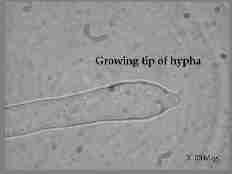 Hyphal growth tip 