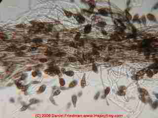 Alternaria mold spores and hyphae from an indoor surface (C) Daniel Friedman