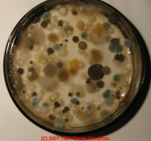 Mold Identification Photographs of Mold Growing on Petri ...