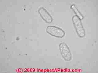 Oidium sp. mildew spores © Daniel Friedman 2001