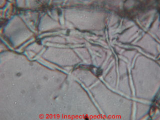 Hyphae and spores from car mold (C) Daniel Friedman at InspectApedia.com
