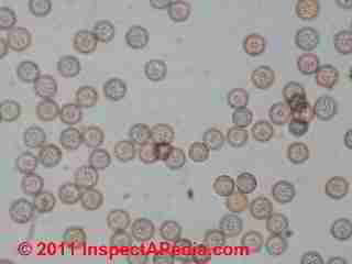 Spores de moisissure Stemonitis (C) Daniel Friedman