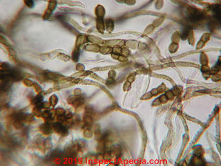 Hyphae and spores from car mold (C) Daniel Friedman at InspectApedia.com