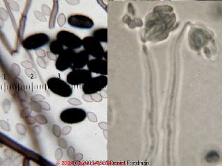 Stachybotrys spores (left) and structure (right)