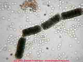 Photograph of  dust mite fecal pellets & Pen/Asp spore chains (C) Daniel Friedman at InspectApedia.com