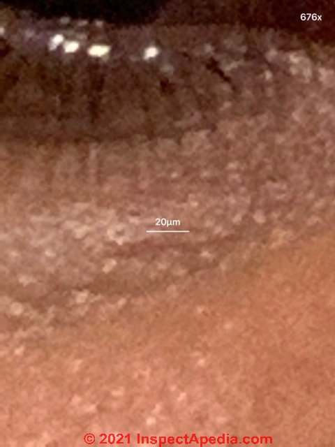 Skin complaint particles on or coming up through skin - see dermatologist (C) InspectApeida.com Liliana G