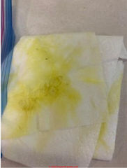 Stain-generating Contaminants in WaterBlack, red, white, yellow, green ...
